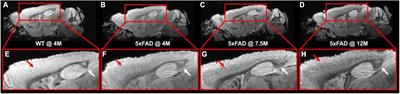 Age-dependent microstructure alterations in 5xFAD mice by high-resolution diffusion tensor imaging